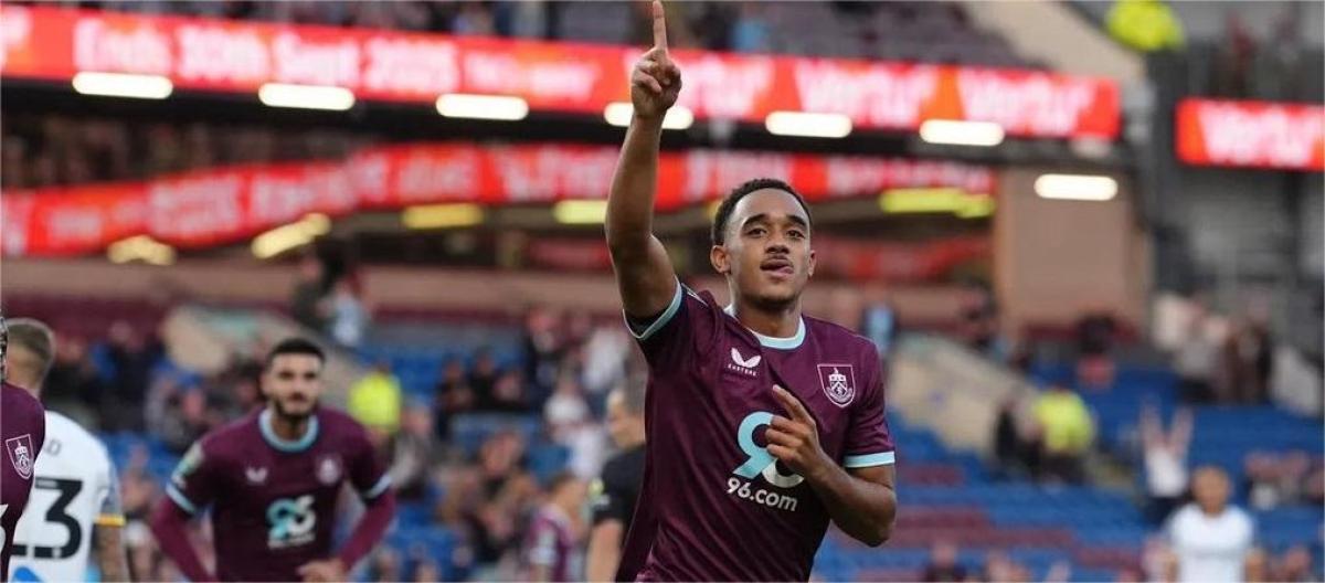 伯恩利晋级联赛杯第3轮的比赛　斯科特·帕克相信球员的状态会越来越好